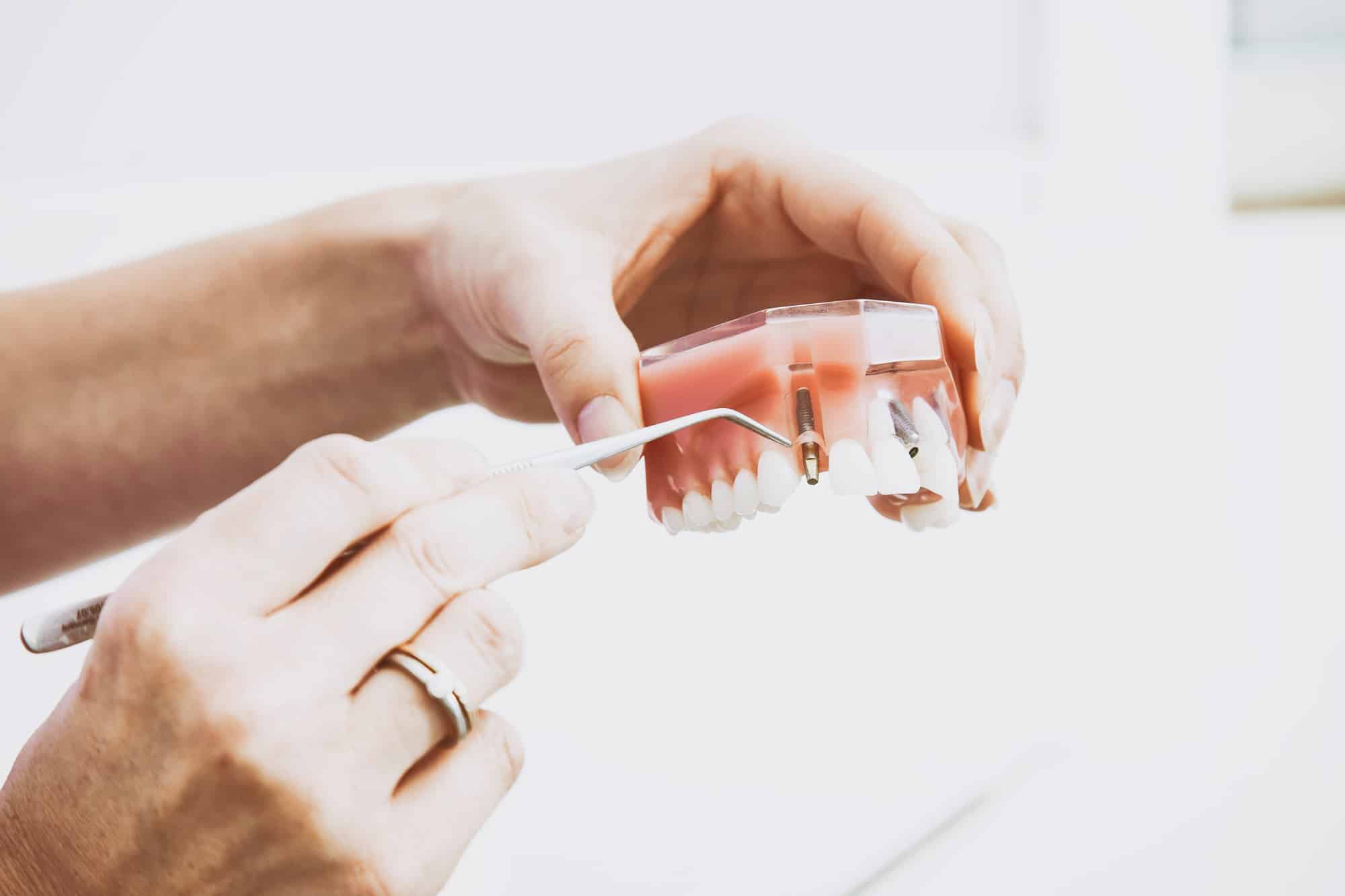 How to a Dental Lab Technician Training, Education & Certification